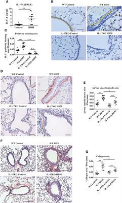 MiR-365-3p is a negative regulator in IL-17-mediated asthmatic inflammation